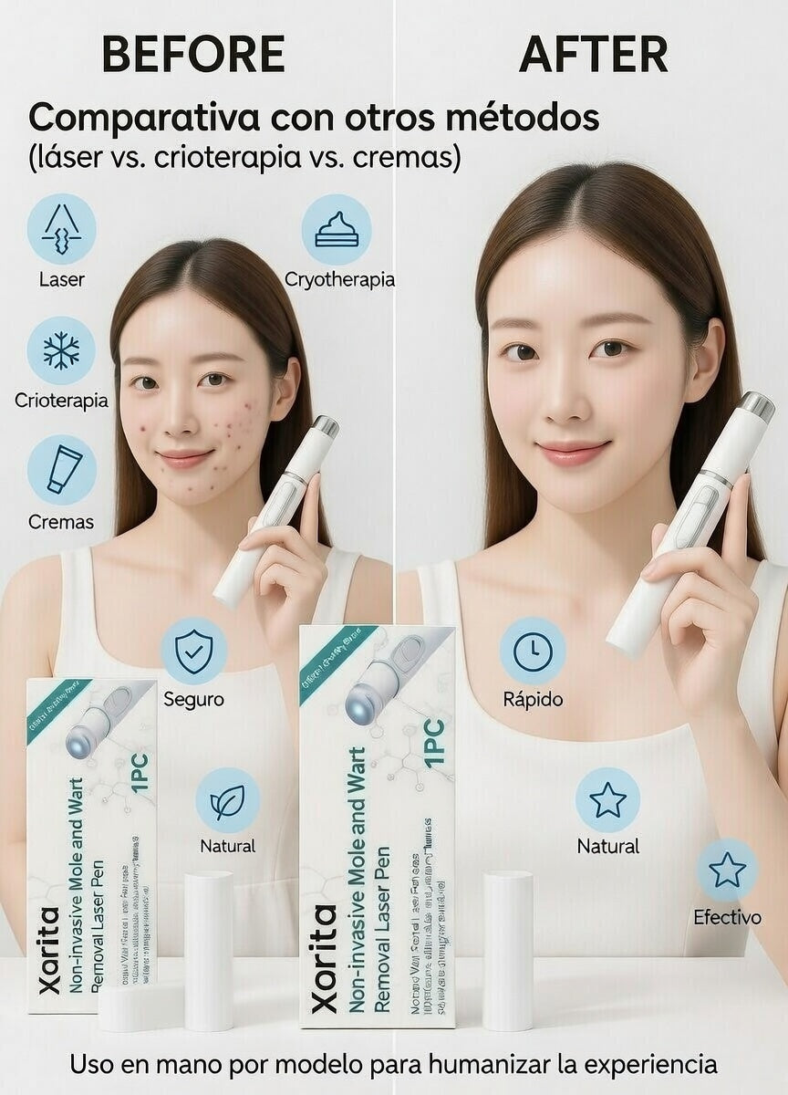 Xorita Precision Skin Pen™ – Dispositivo Cosmético de Uso Personal