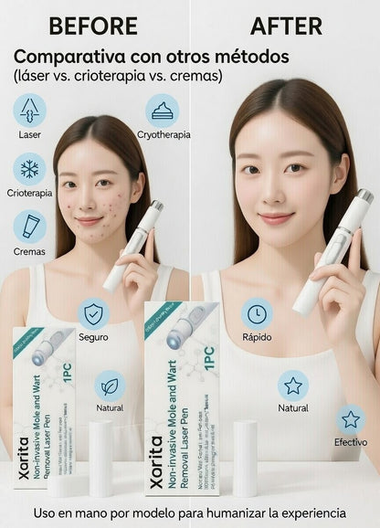 Xorita Precision Skin Pen™ – Dispositivo Cosmético de Uso Personal